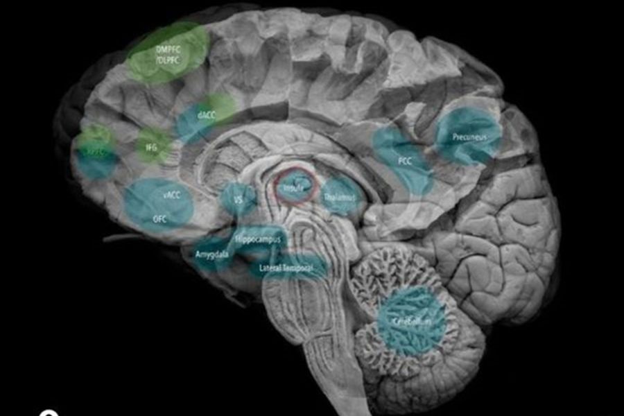 neurosonografia fetal desde las 20 a 41 semanas